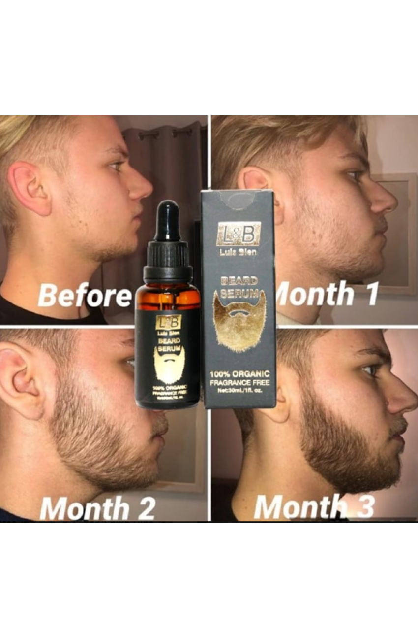 سيروم انبات اللحية لويس بيان